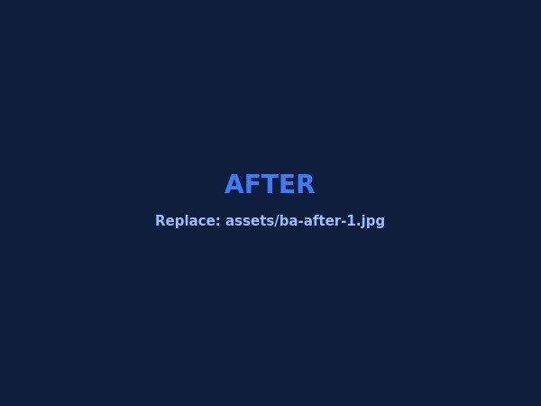 Before & After