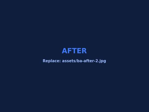 After — Digitalized fabric