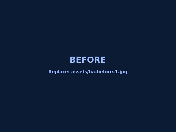 Before — Flat sketch